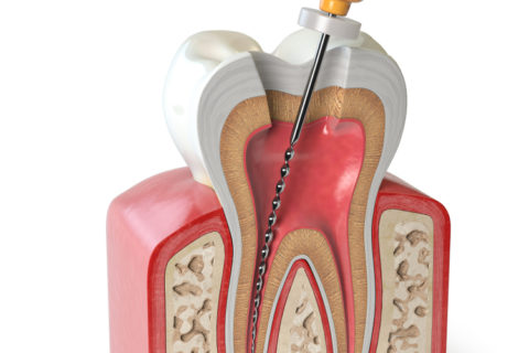 ENDODONCIJA